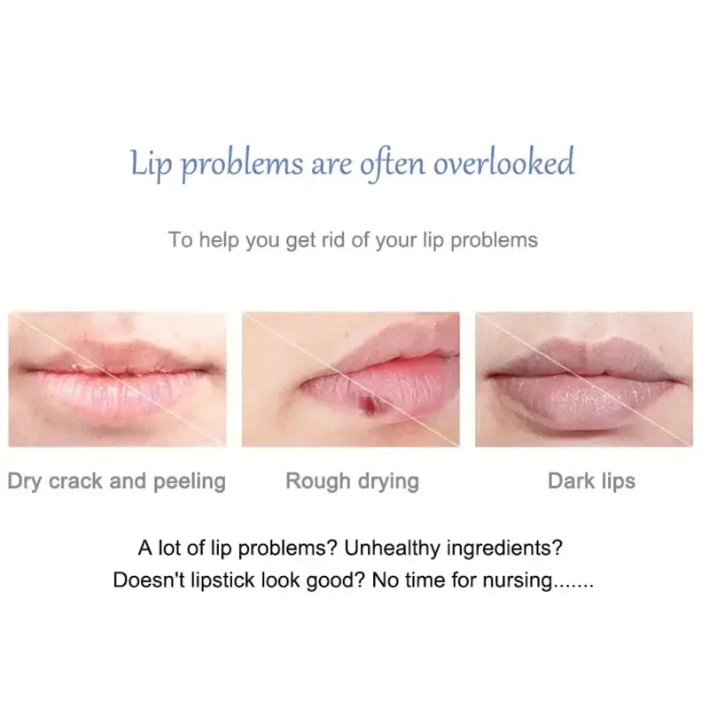 Remove Dark Lip Balm Lighten Melanin Lip Mask Exfoliating Fade Lip Line Dead Skin Moisturizing Brighten Repair Lip Care Product