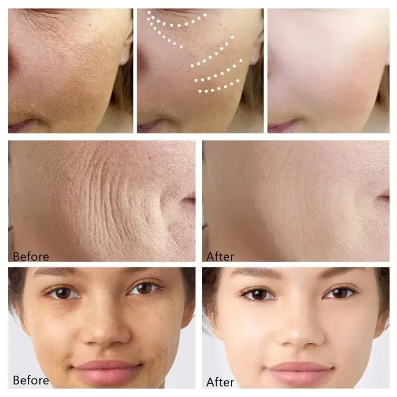 Wrinkle Remove Serum Anti-Aging Essence Fade Fine Line Lifting Firming Whitening Skin Care