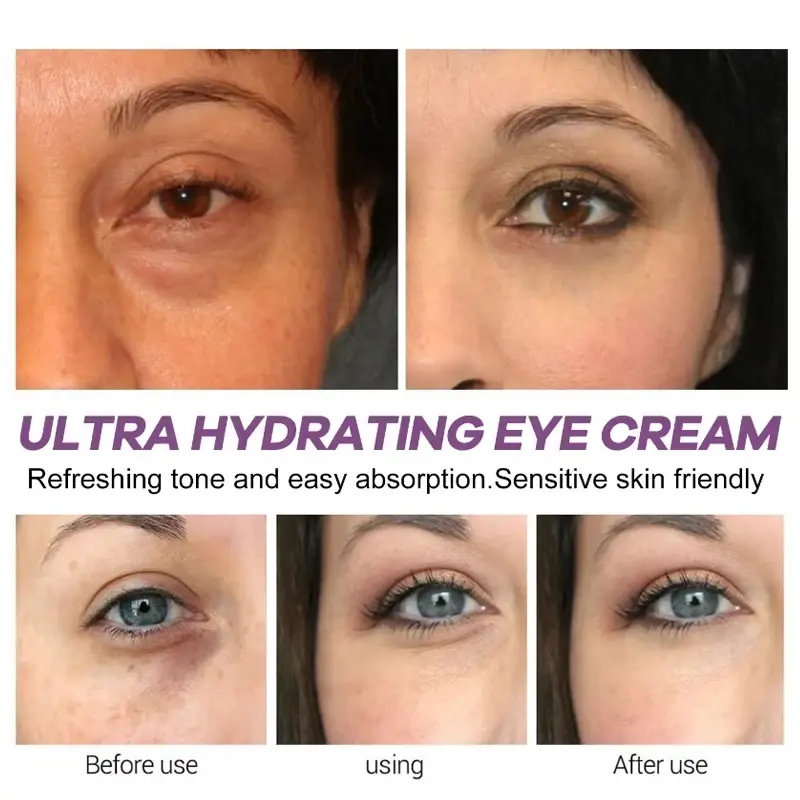 Instant Eye Bag Removal Cream Retinol Anti-Wrinkle Firming Skin Fade Fine Lines Anti Dark Circle Puffiness Brighten Eye Care