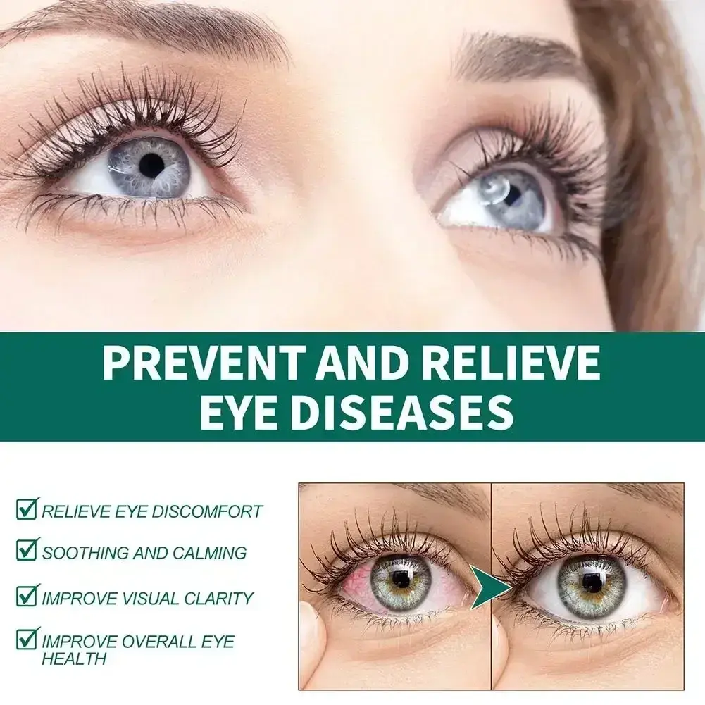 Cool Eye Drops Medical Cleanning Detox Relieves Discomfort Removal Fatigue Improve Vision Relax Massage Eye Care