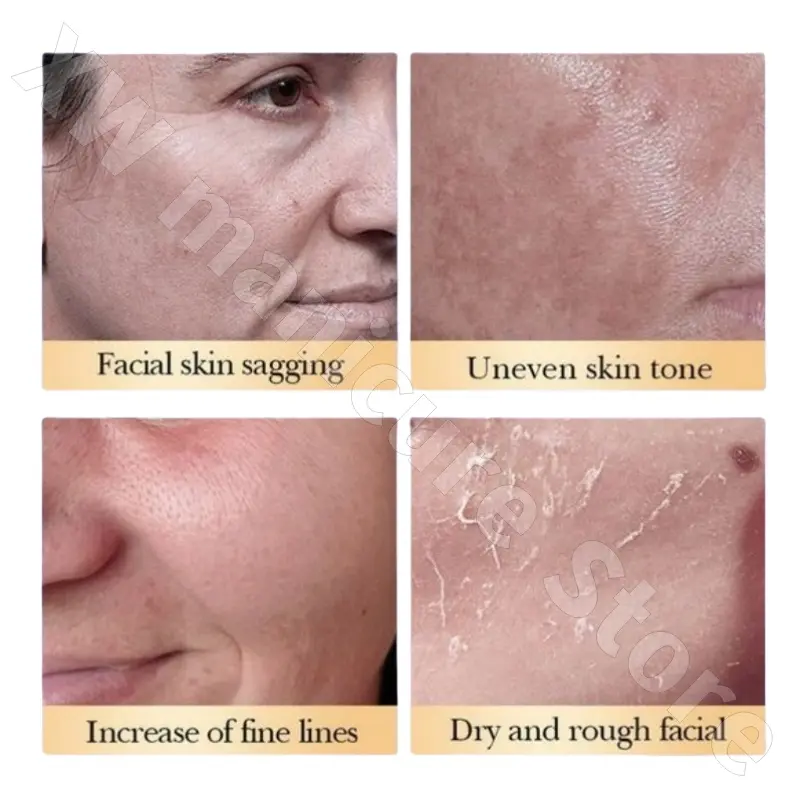 ACM Brightening and Nourishing Essence Cream 200ml Moisturizing and Long-lasting Fragrance To Improve Facial Darkness 40ml