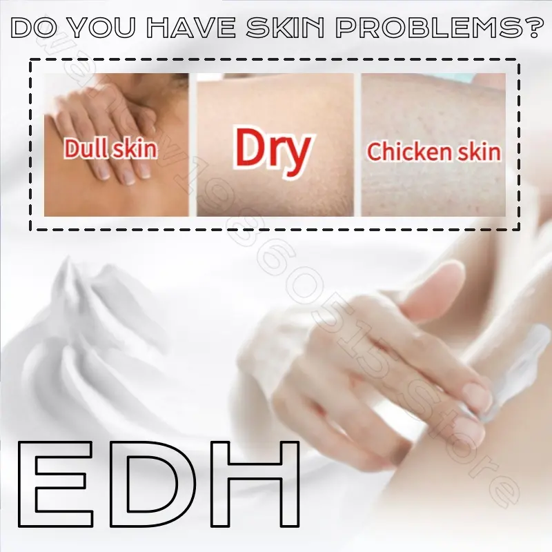 EHD Brighten Skin Tone Moisturizing Body Lotion Refreshing and Non-sticky Prevent Dryness Niacinamide Hydrating Body Lotion 200g