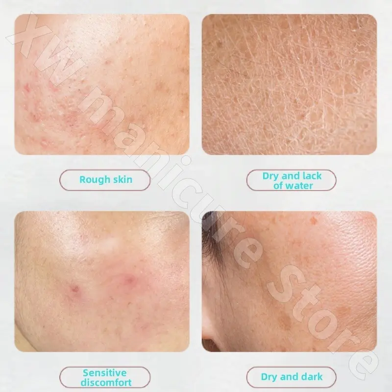Kenta Cream Brightens Skin Tone Moisturizes Hydrating Repairs Sensitive Skin Improves Redness and Darkness 30g