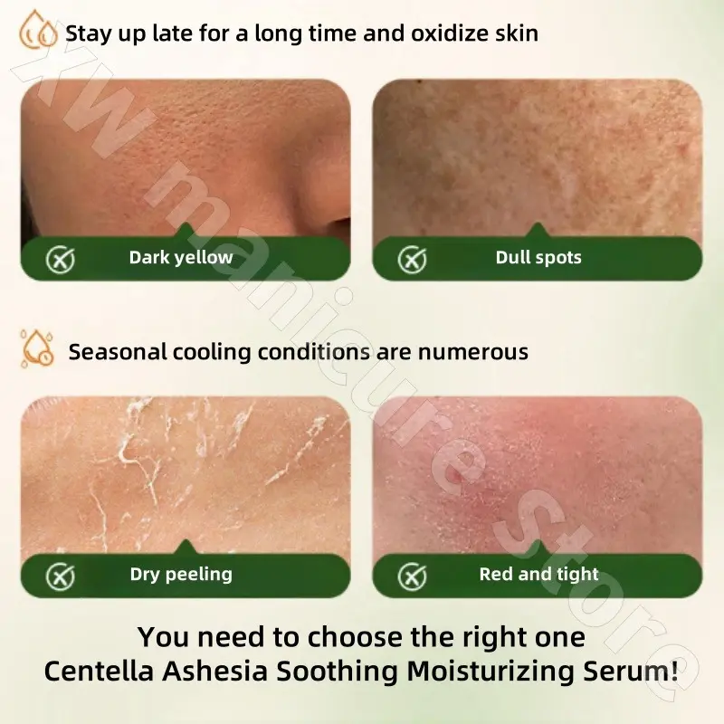 Purito Centella Assay Non-flavored Essence Ampoule Soothing Calm and Moisturizing Skin and Beautifying Facial Serum Essence 60ml