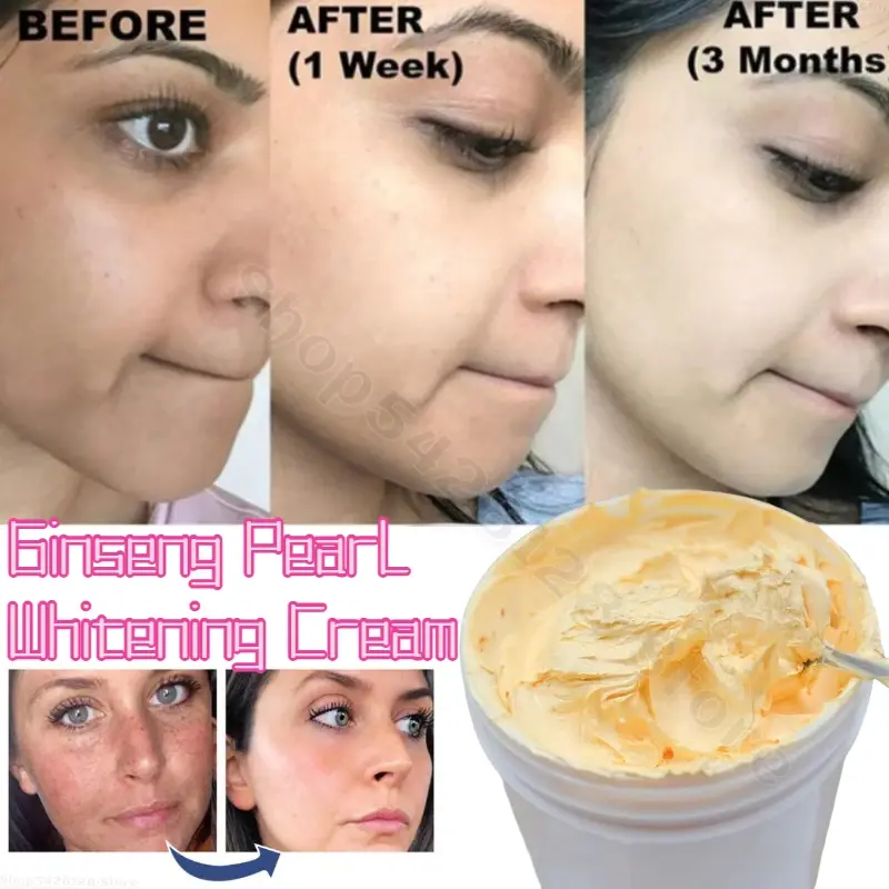 Strong Effective Best Bleaching Whitening Cream Facial Neck Hands Feet Without Side Effects Dark Black Skin Bleaching Cream 1KG