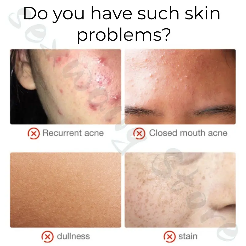 eLL non-face cream brightens the skin tone to improve dull spots acne marks moisturizing moisturizing refreshing and not sticky