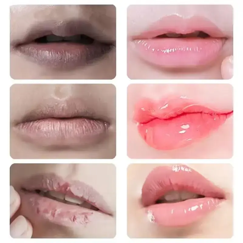 Lip Balm For Remove Dark Lip Melanin Dead Skin Removal Lighten Exfoliate Whitening Moisturizing Nourishing Lip Care