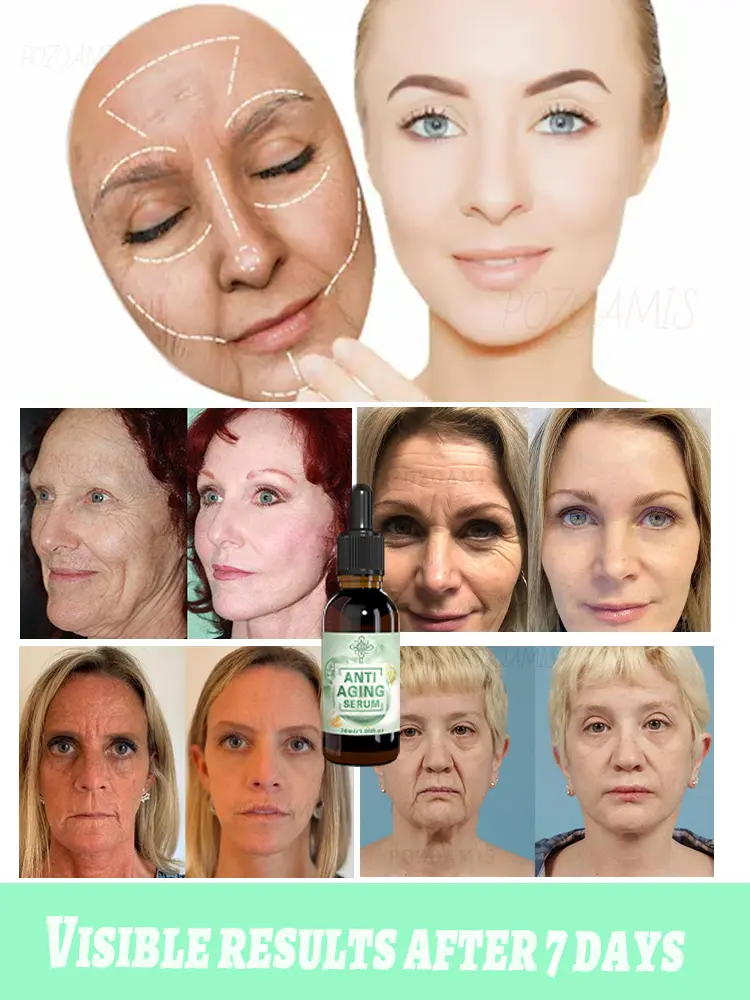 Wrinkles disappear,20 years younger