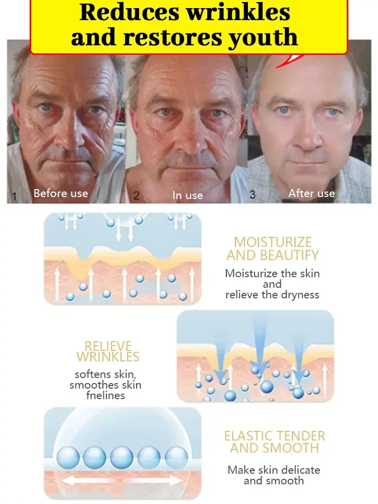 Wrinkles disappear,20 years younger