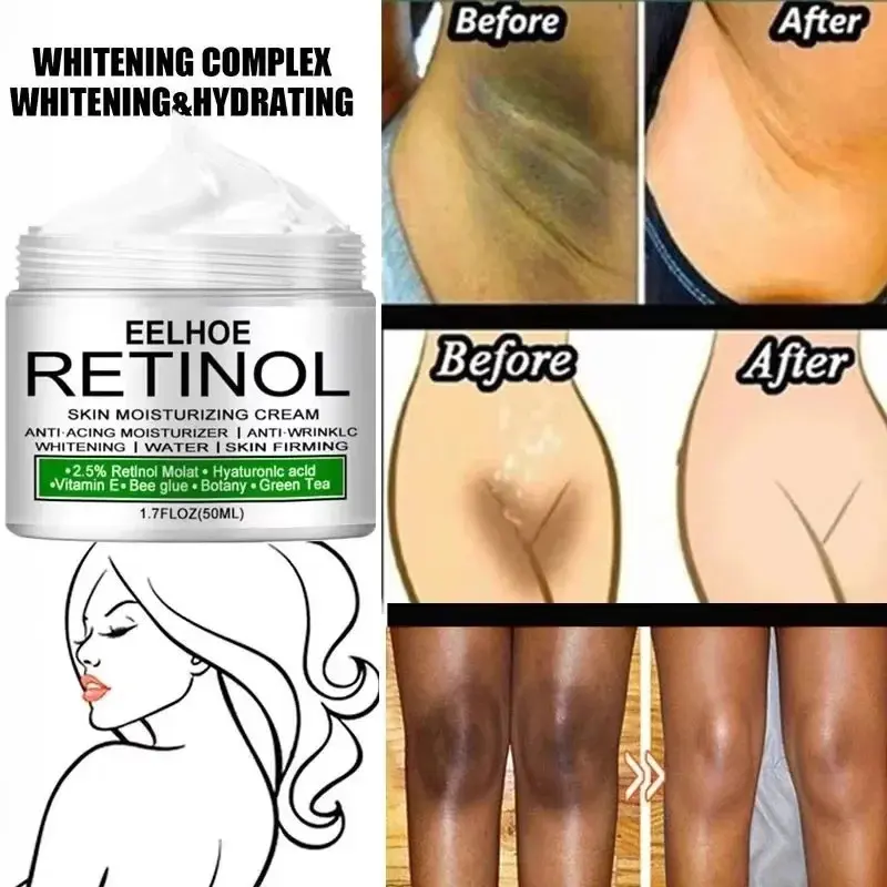 Body Whitening Cream Dark Skin Armpit Lightening Intimate Areas Underarm Bleaching Private Parts Whiten Cream Body Lotion Beauty