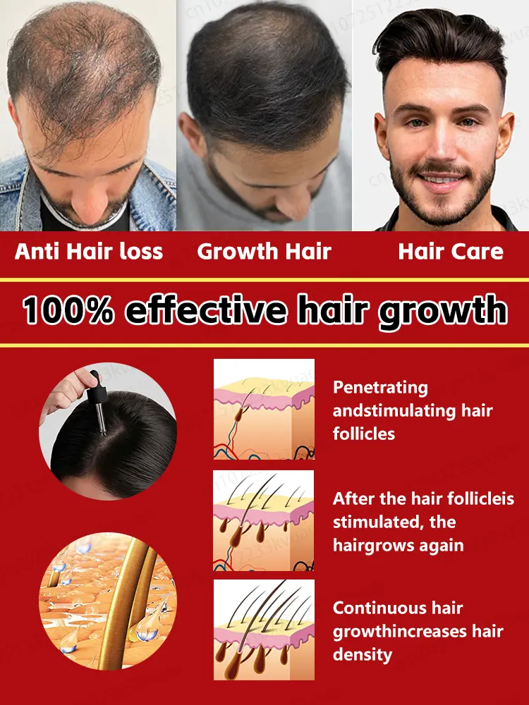 Rosemary hair growth essential oil, repair baldness and hair loss, seborrheic alopecia, hereditary hair loss, middle-aged hair l