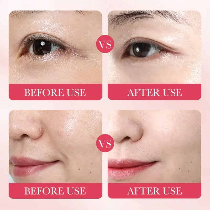 5/10 PCS Korean Snail Mucin Sheet Mask Hydrating Repair Brightening Anti-Aging Wrinkle Moisturizing Gel Face Mask for All Skin