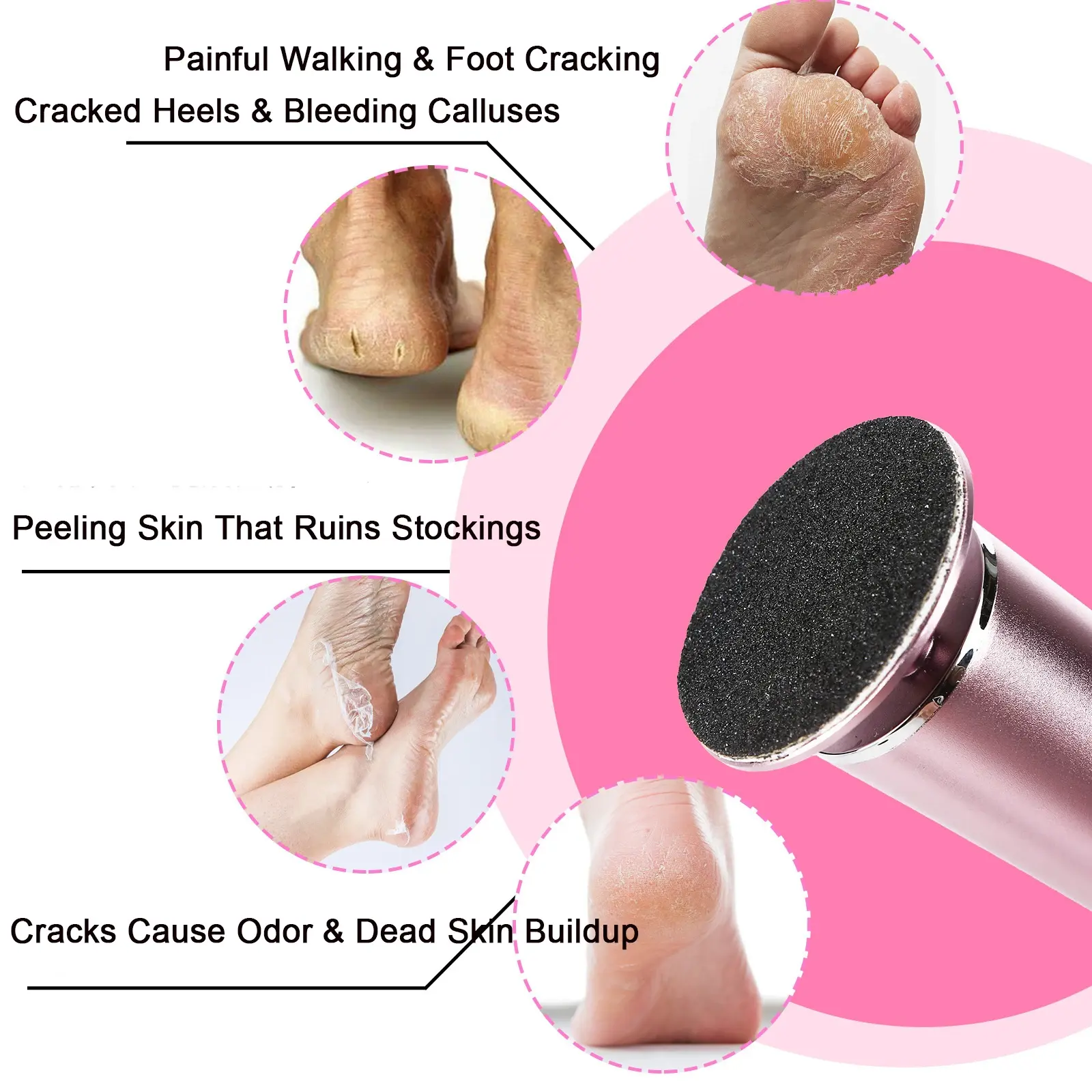 Electric Callus Remover - Professional Foot File & Pedicure Tool for Dead Skin & Cracked Heels Includes 60 Replacement Sandpaper