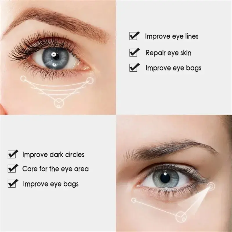 Anti-Aging Eye Cream - Moisturizes Reduces Dark Circles & Wrinkles - Under-Eye Skin Care for Brighter Eyes