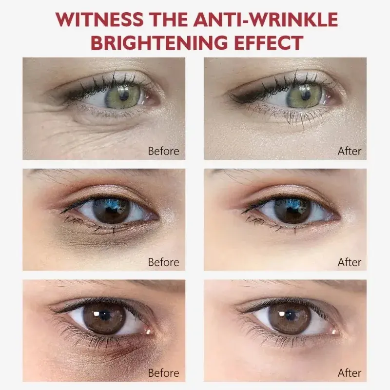 Anti-Aging Eye Cream - Moisturizes Reduces Dark Circles & Wrinkles - Under-Eye Skin Care for Brighter Eyes