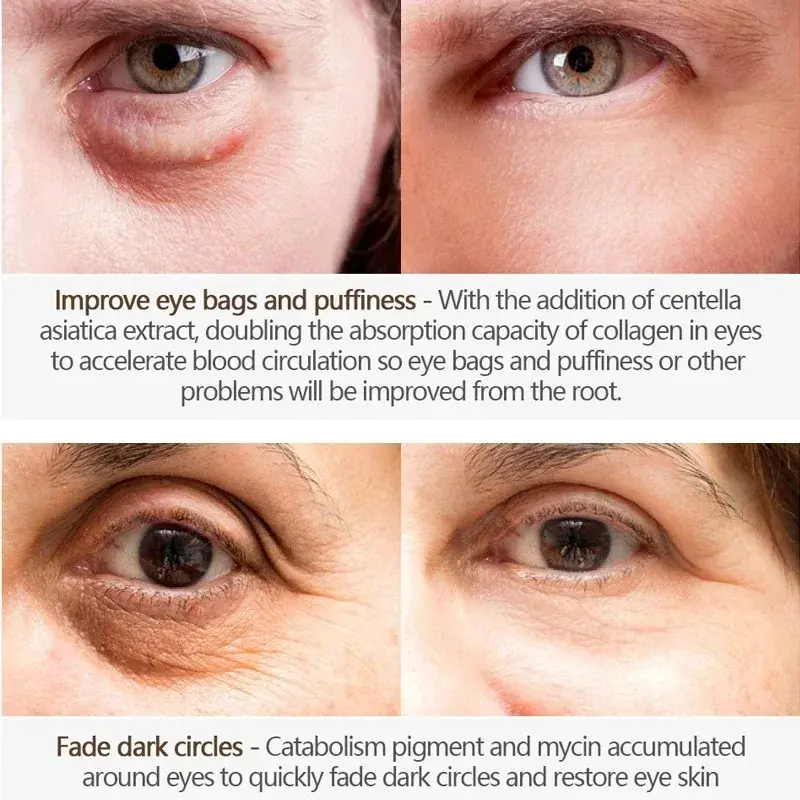 Anti-Aging Eye Cream - Moisturizes Reduces Dark Circles & Wrinkles - Under-Eye Skin Care for Brighter Eyes