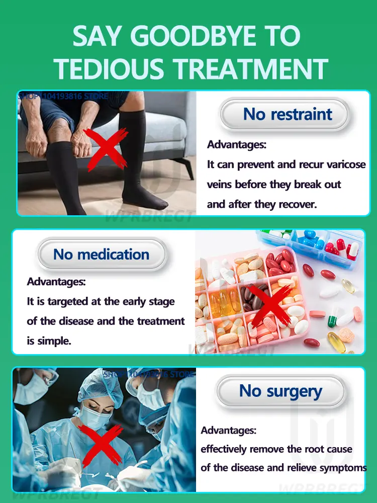 2nd generation varicose vein laser eliminates vasculitis and phlebitis, relieves spider leg pain, laser pointer for treatment