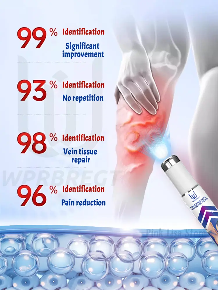 2nd generation varicose vein laser eliminates vasculitis and phlebitis, relieves spider leg pain, laser pointer for treatment