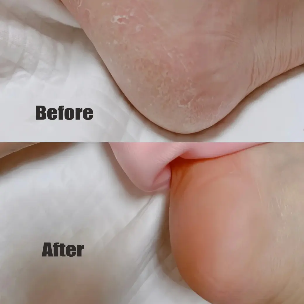 1Pair Silicone Foot Care Socks Anti Cracking Moisturizing Gel Elastic Socks DIY Foot Mask Cracked Dead Skin Remove Pedicure Tool