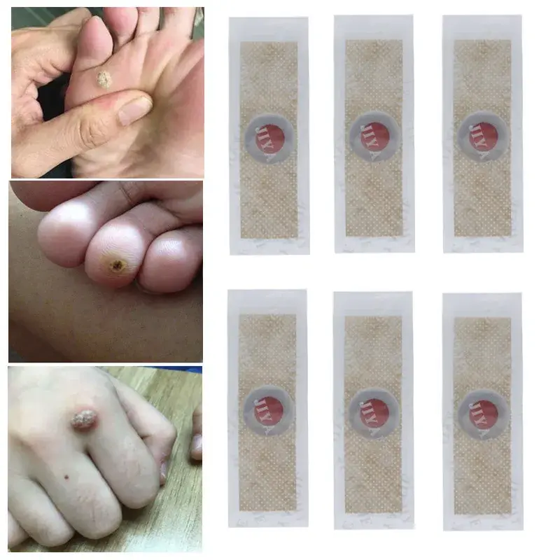 30PCS Toe And Foot Protectors Pads Corns Callus Feet Sore Shoes Sticker Self Adhesive Cushions Soft Heel Pad Foam Foot Paste