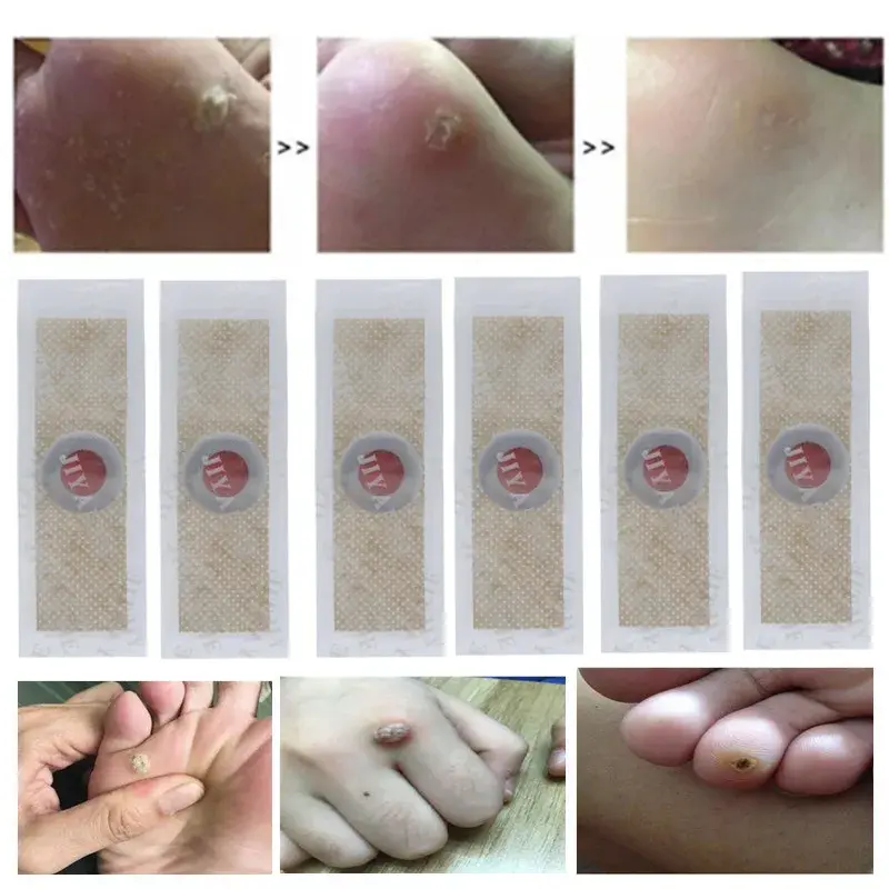 30PCS Toe And Foot Protectors Pads Corns Callus Feet Sore Shoes Sticker Self Adhesive Cushions Soft Heel Pad Foam Foot Paste