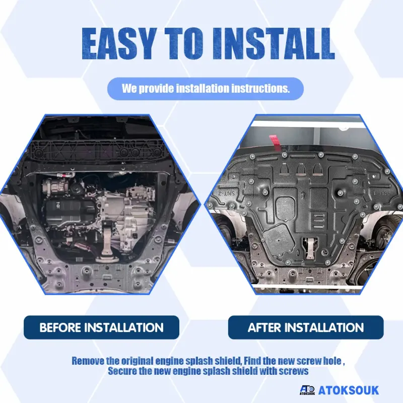 Car Engine Splash Shield Guard For Hyundai Sonata 2020 2021 2022 2023 Engine Under Cover Front Splash Guard Mud Flaps