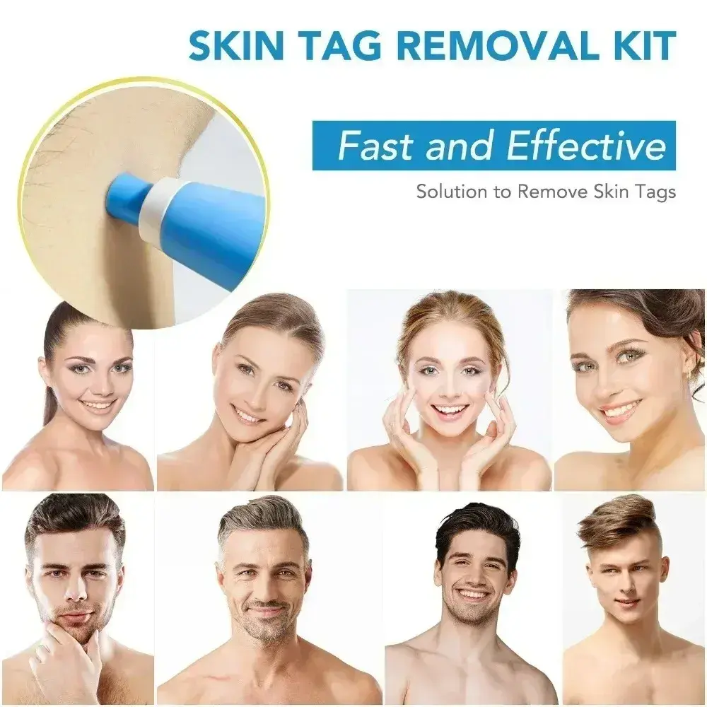 Acne Remover 2 IN 1 Auto Micro Skin Tag Remover Device Tag Removal Kit Adult Mole Wart Remover Face Care Beauty Tools