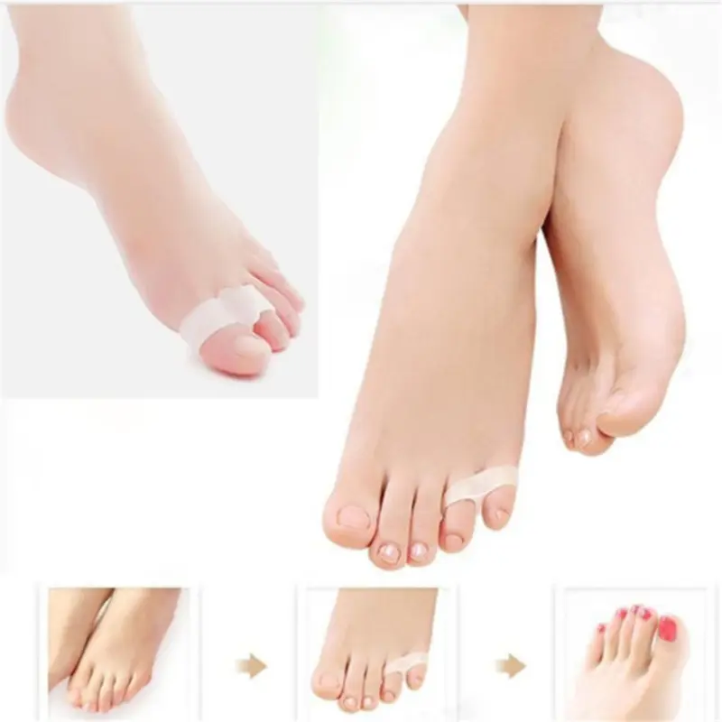 1~30pair Silicone Gel Correction  Hallux Valgus Foot Care Toe Separator Little Finger Protector Bunion Adjuster Protetor New