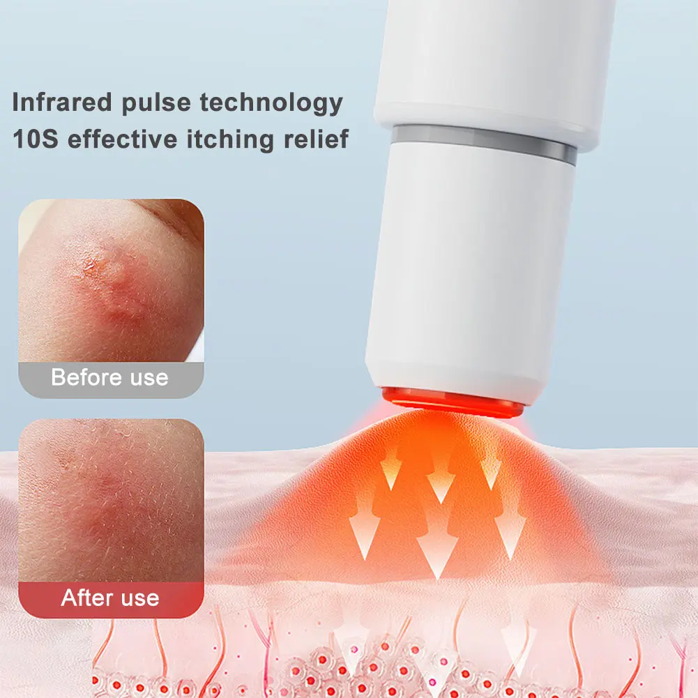 Mosquito Insect Bite Relieve Itching Pen Natural Bug Bite Itch Portable Relief Pen Rechargeable Anti-Itch Pen for Adult Children