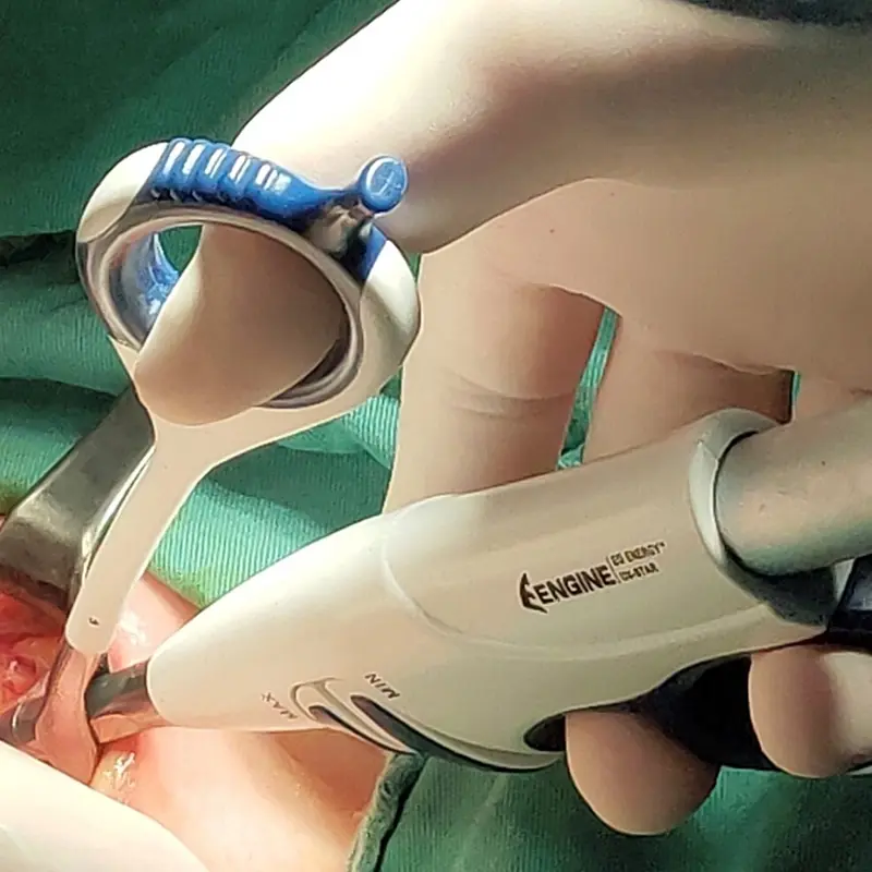 Manufacturer Ultrasonic Cutting Hemostatic Ultrasonic Knife Scalpel for Pet and Surgical Operations Reuse Scalpel