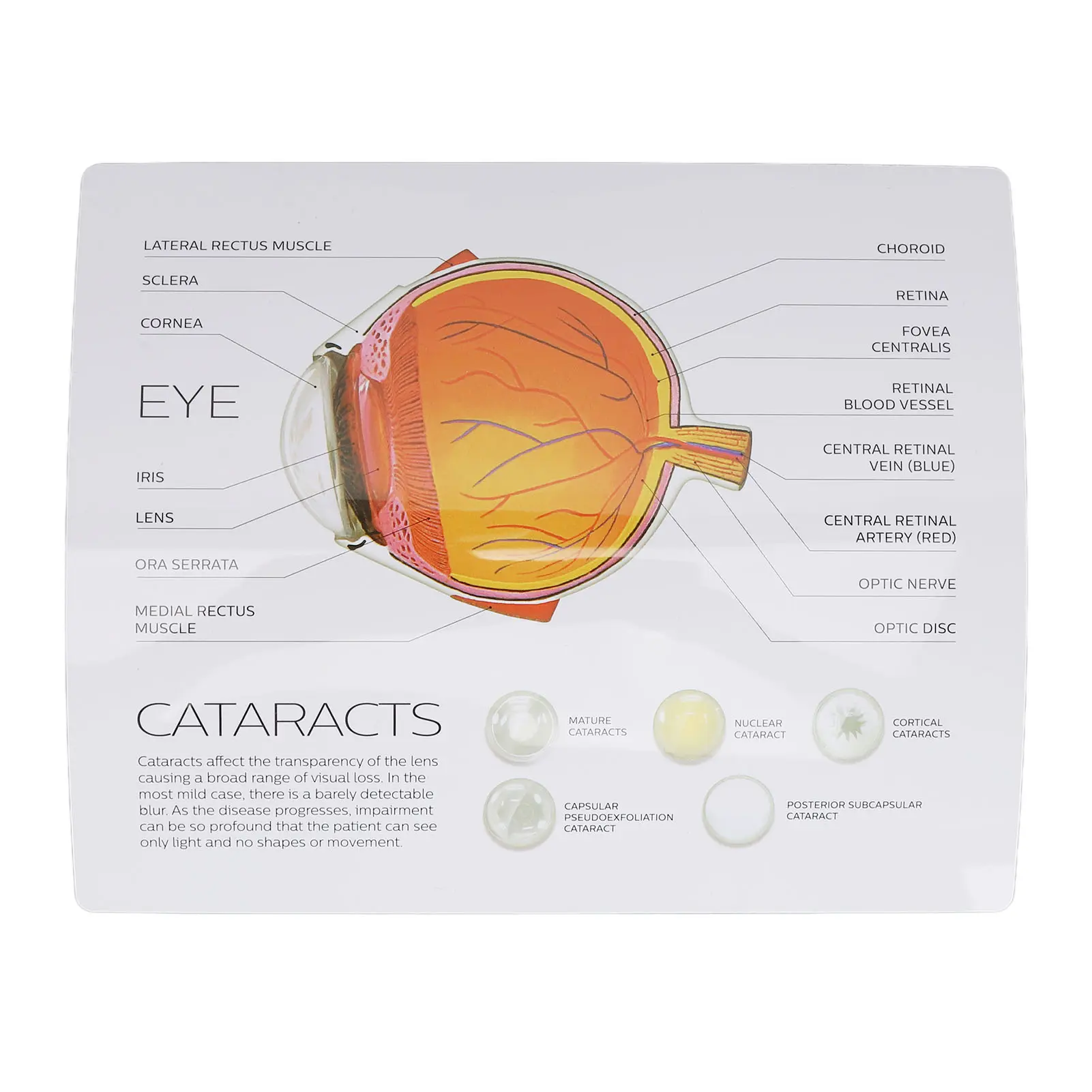 Human Eye Anatomical Model Human Eye Anatomical Model Accurate Display Enlarged  Eyeball Explanation Model with Card