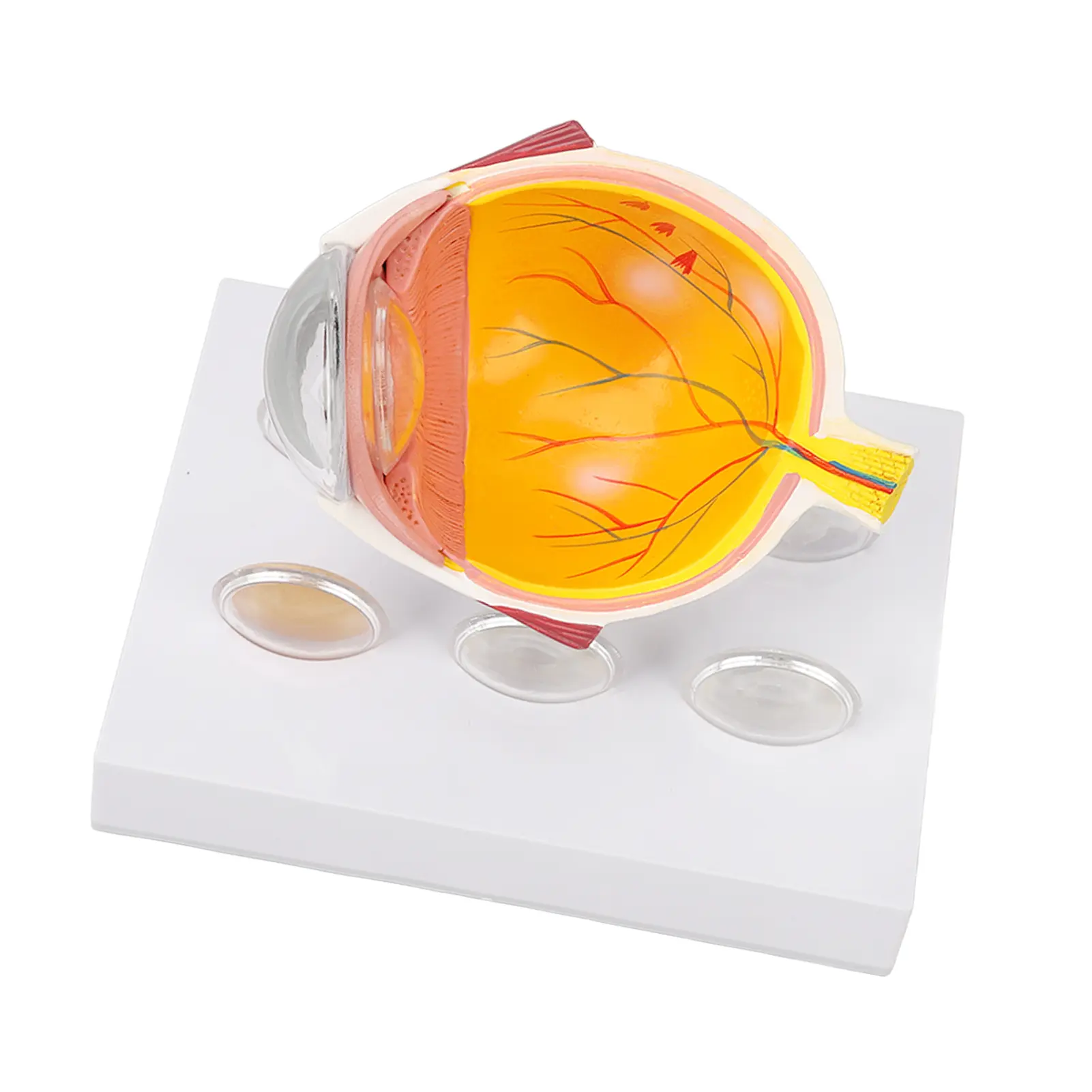 Cataracts Eyeball Model Enlarged Human Eye Anatomical Model Accurate Shows Optic  Cornea  Lens  Eyeball Model