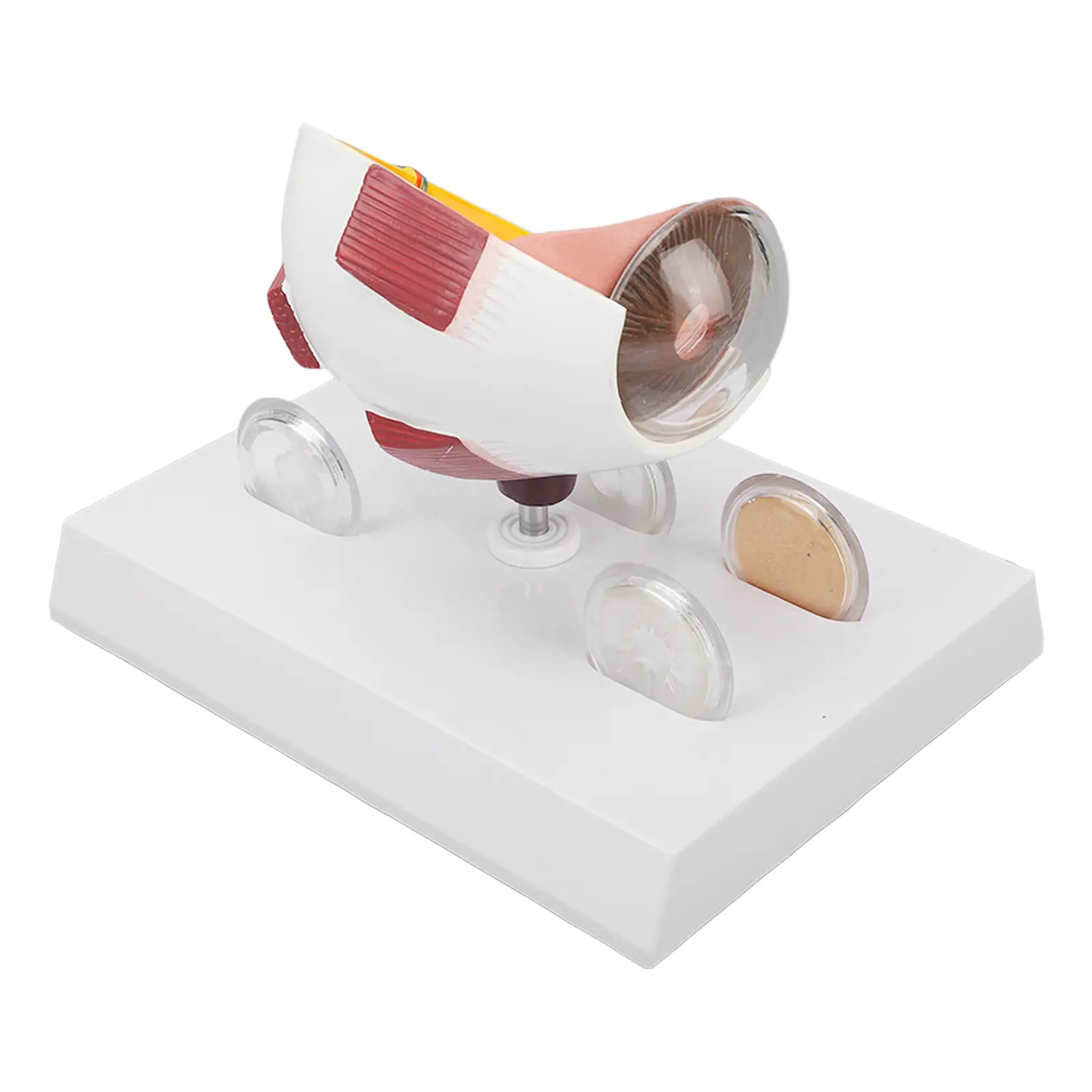 Cataracts Eyeball Model Enlarged Human Eye Anatomical Model Accurate Shows Optic  Cornea  Lens  Eyeball Model