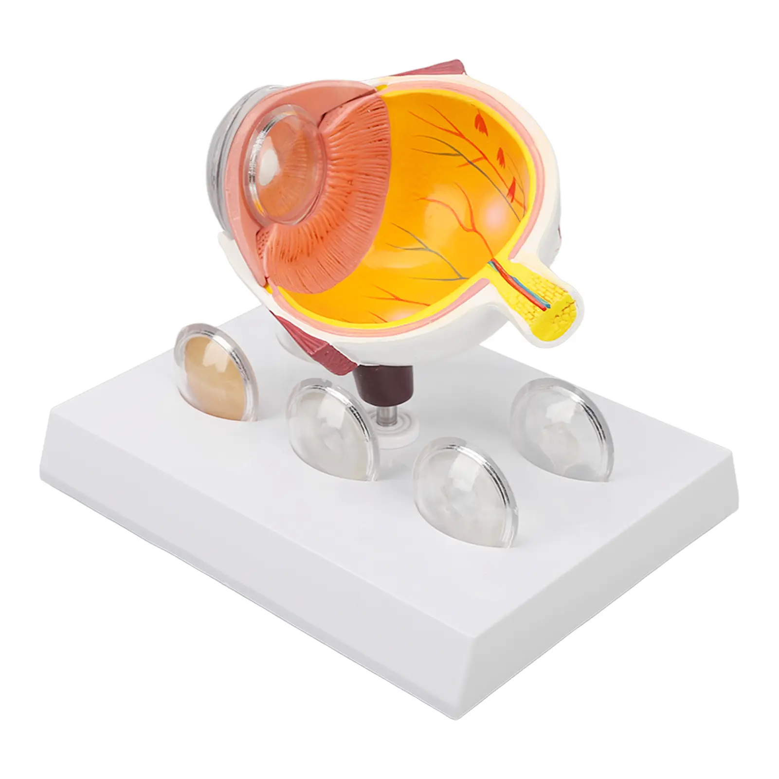 Cataracts Eyeball Model Enlarged Human Eye Anatomical Model Accurate Shows Optic  Cornea  Lens  Eyeball Model