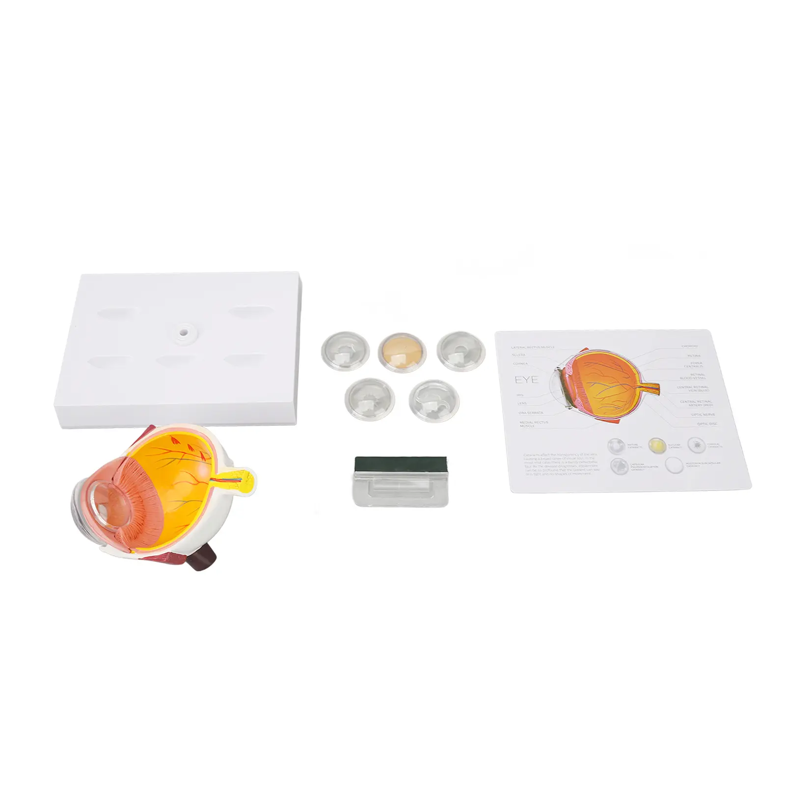 Cataracts Eyeball Model Enlarged Human Eye Anatomical Model Accurate Shows Optic  Cornea  Lens  Eyeball Model