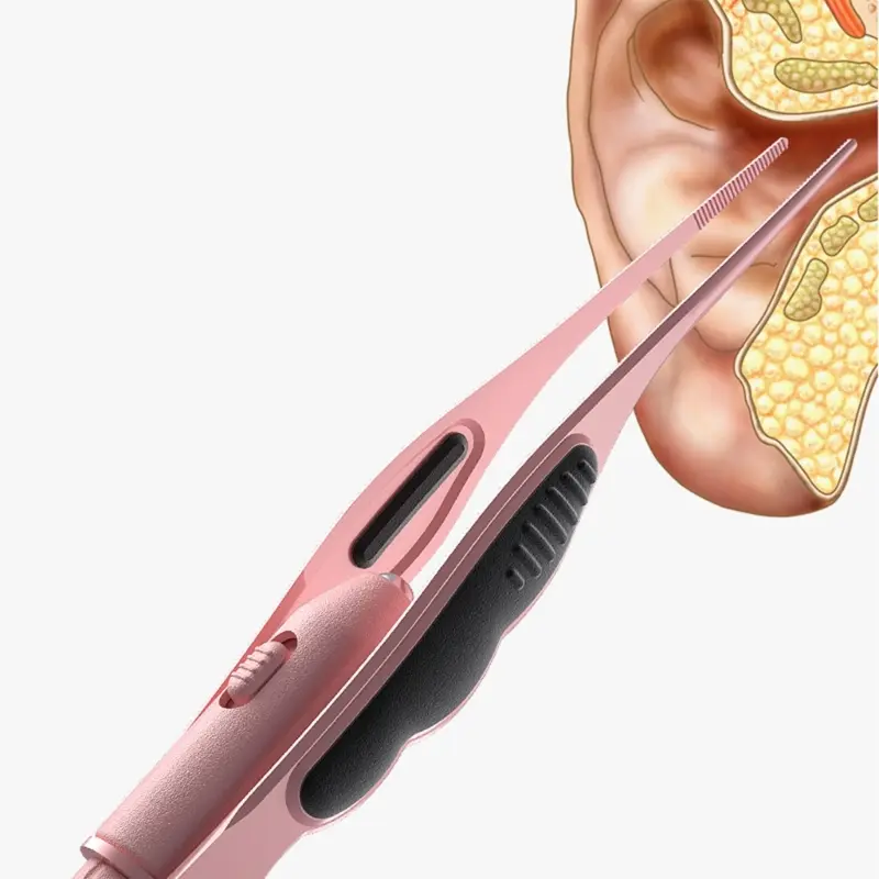 Baby Care LED Ear Wax Removal Tweezers Anti-Skid Ear Pick Tool with Brightness Light Ear Curette Safety Earwax Cleaning Tool