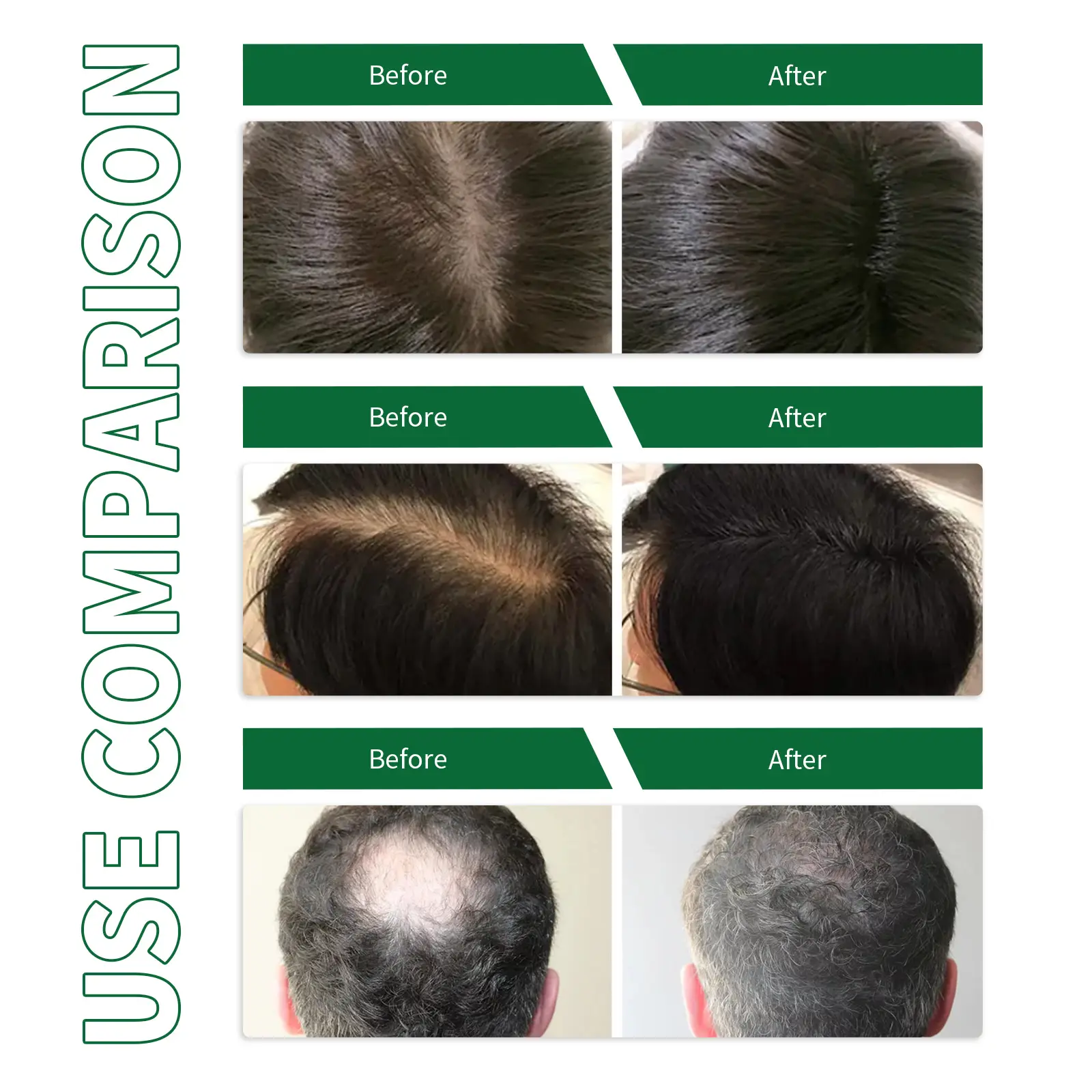 OUHOE Hair Regrowth Serum Spray Repairing Split Ends Scalp Dry Damaged Promote Growing Strengthening Nourishing Roots Spray 35ml