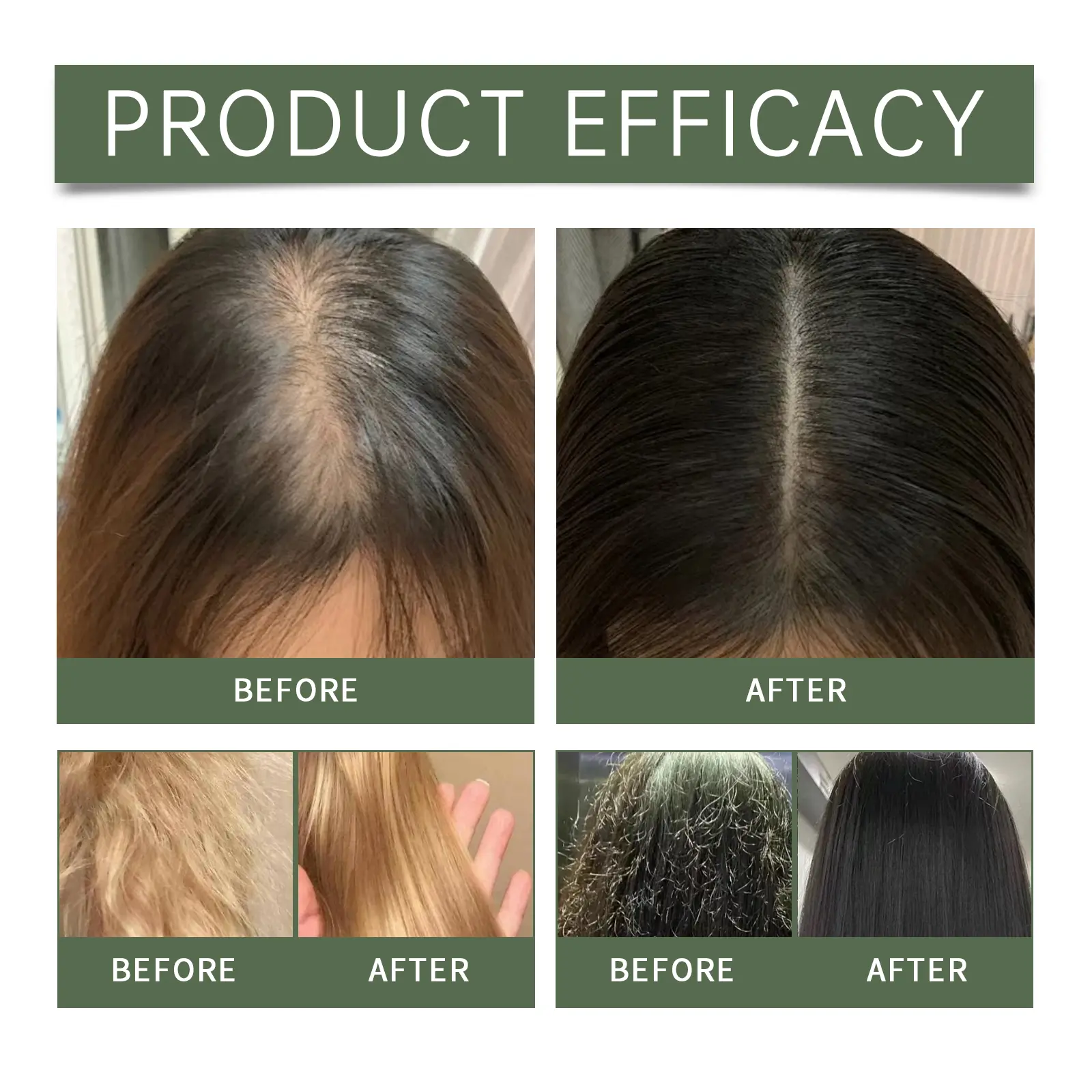 Rosemary Hair Care Set Hair Growth Serum Split Ends Dry Nourishing Treatment Hair Mask Conditioner Hair Strengthening Shampoo