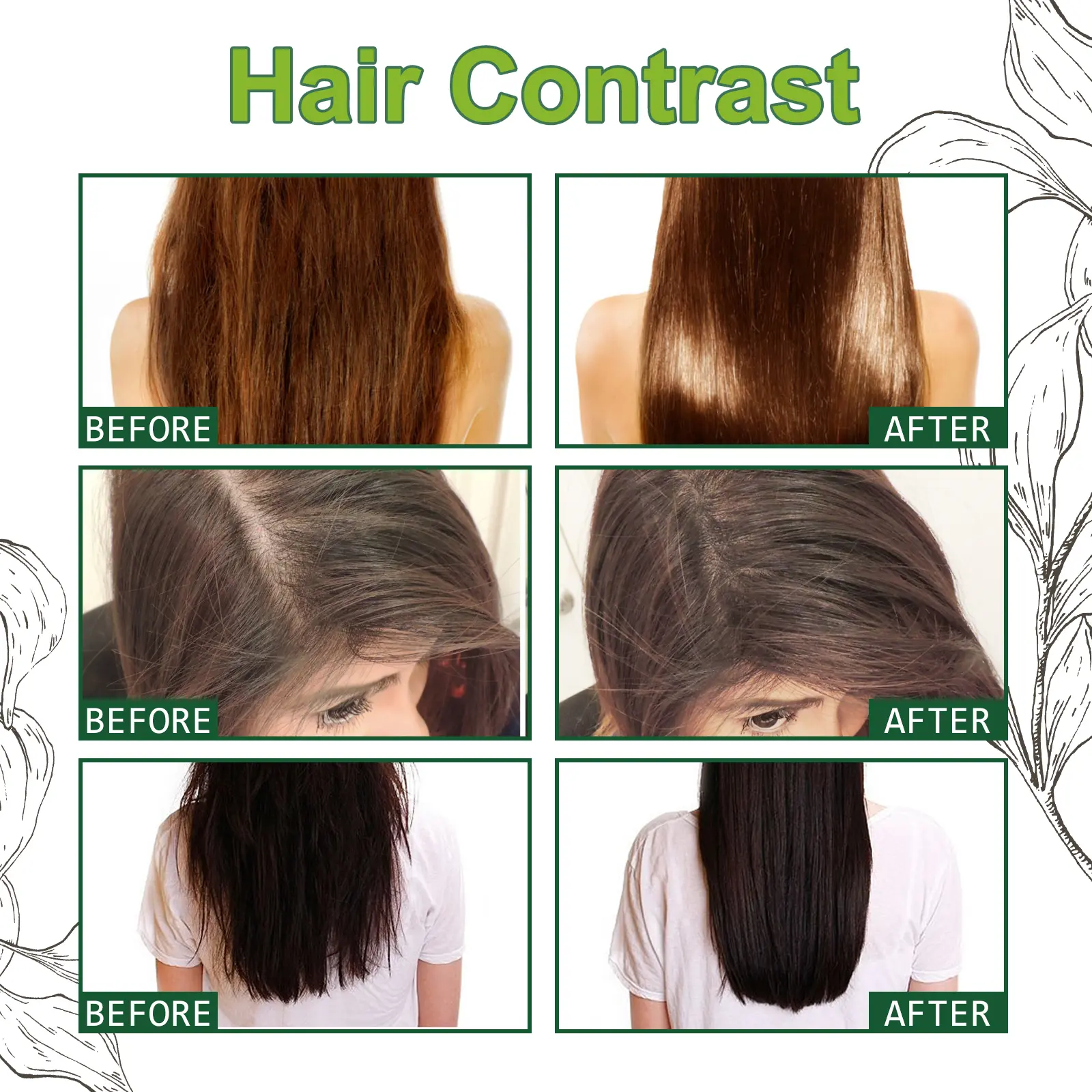 Fast Hair Growth Anti Alopecia Oil Ginger Essential High Hairline Head Hair Serum Hairless Baldhead Increase Essence Cream