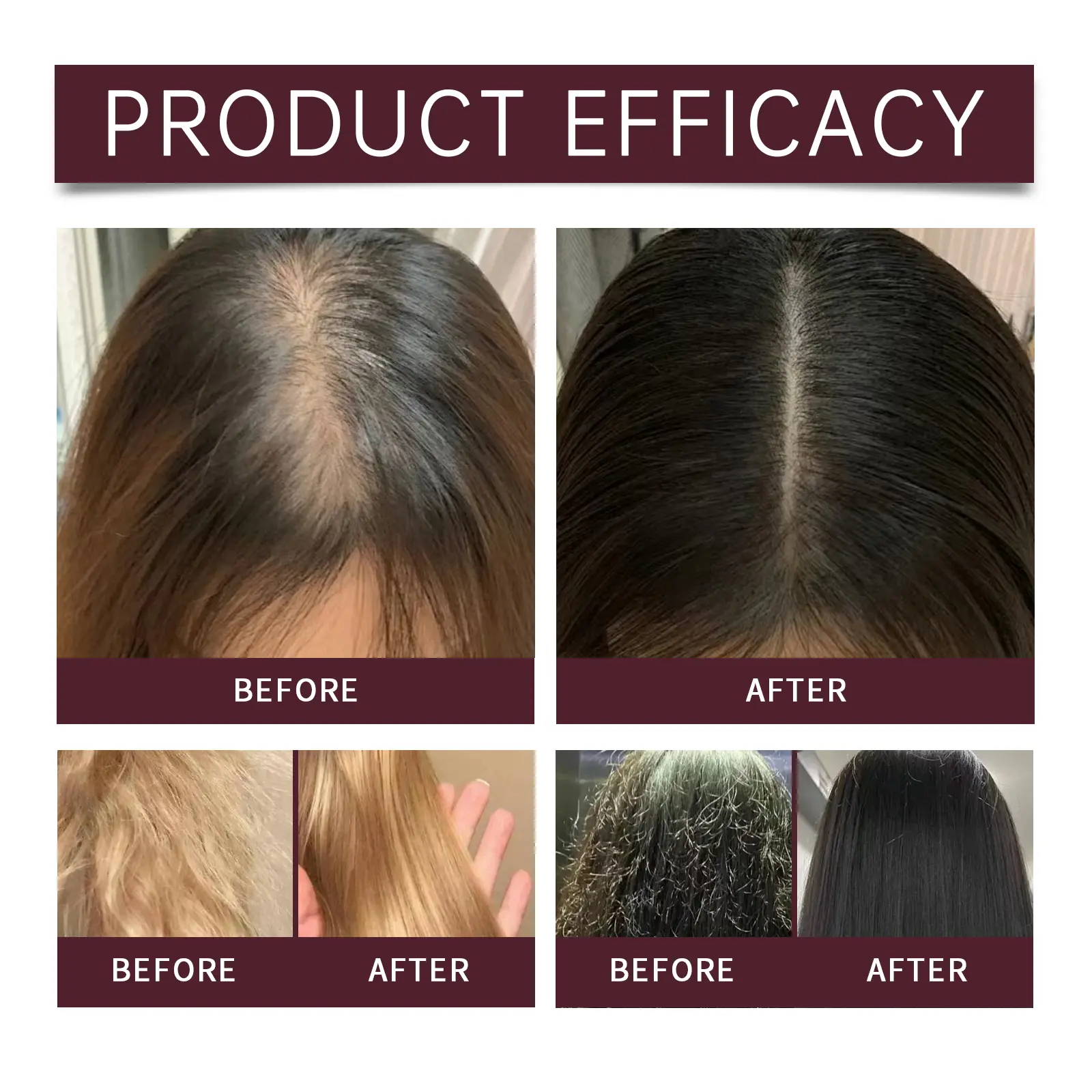 Batana Oil Shampoo Conditioner Set Oil Control Anti Dandruff Scalp Hair Treatment Split Ends Anti Frizz Hair Loss Hair Care Set