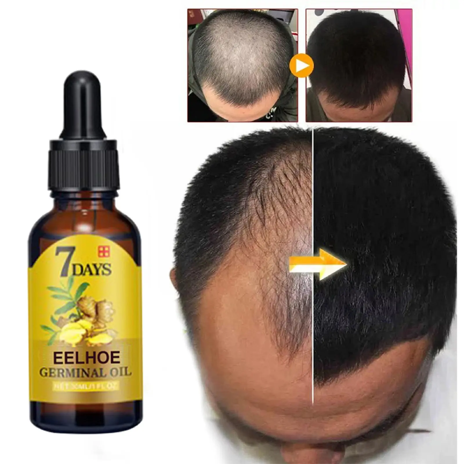 Ginger Hair Essential Oil 100% Polygonum Multiflorum Thunb Nourish Dry Pure Natural Hair Care Repair Damaged Scalp