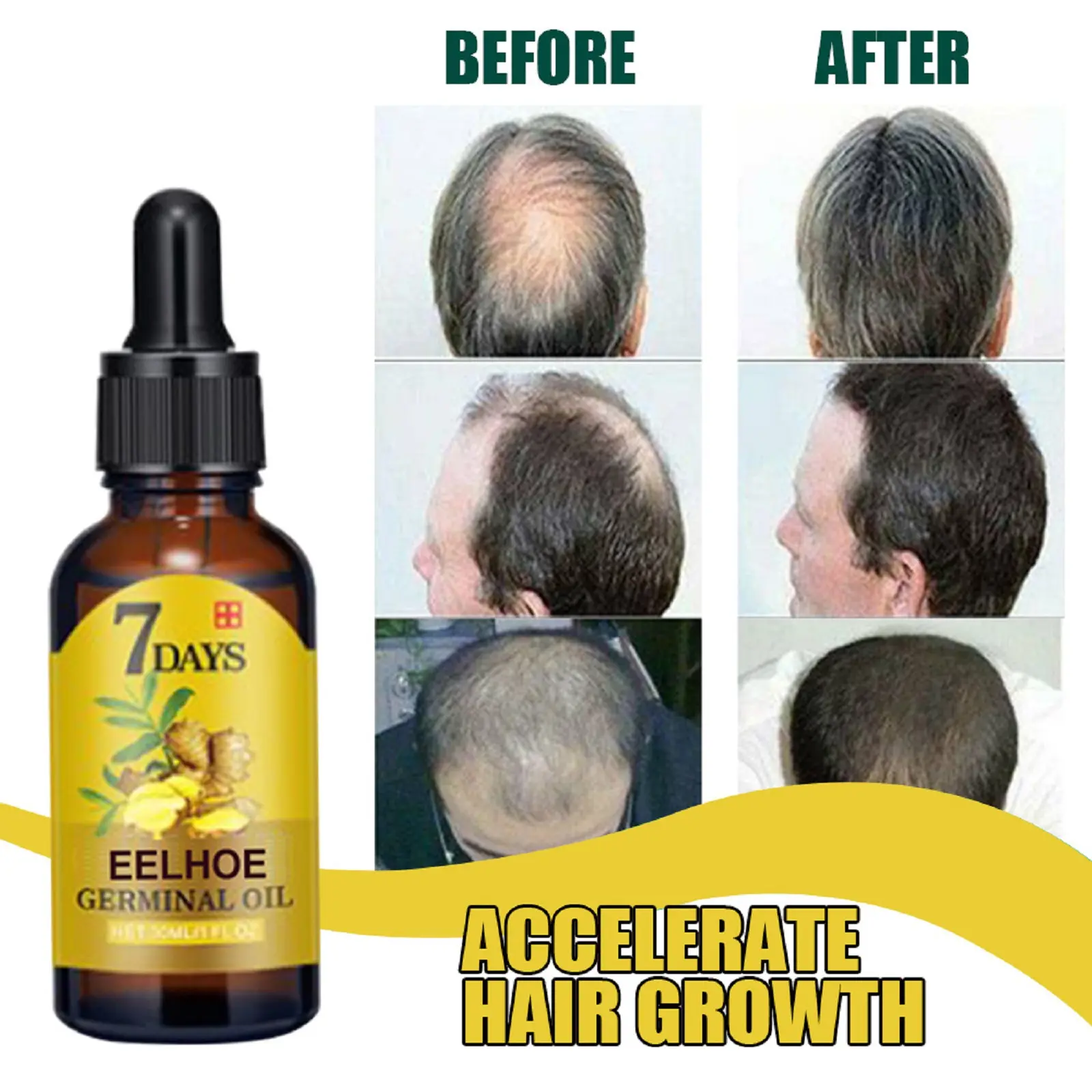 Ginger Hair Essential Oil 100% Polygonum Multiflorum Thunb Nourish Dry Pure Natural Hair Care Repair Damaged Scalp