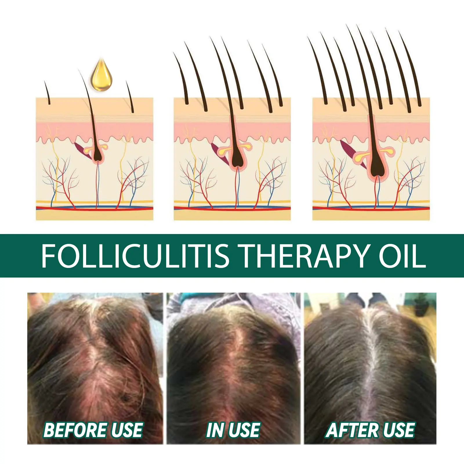 Hair Oil Serum Strengthening Smooth Silky Weak Hair Thicker Fuller Nourishing Scalp Treatment for Men Women Hair Care Products