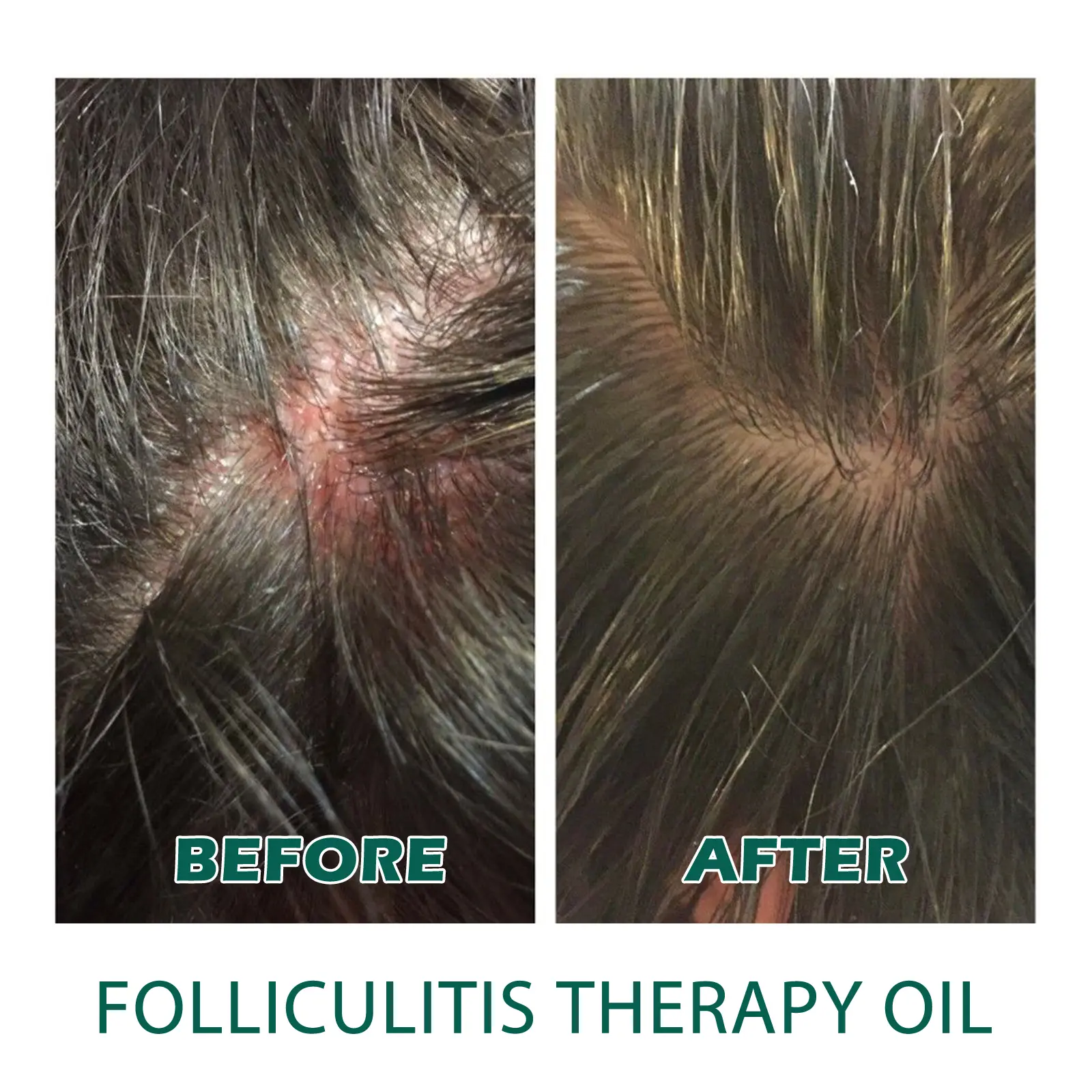 Hair Oil Serum Strengthening Smooth Silky Weak Hair Thicker Fuller Nourishing Scalp Treatment for Men Women Hair Care Products