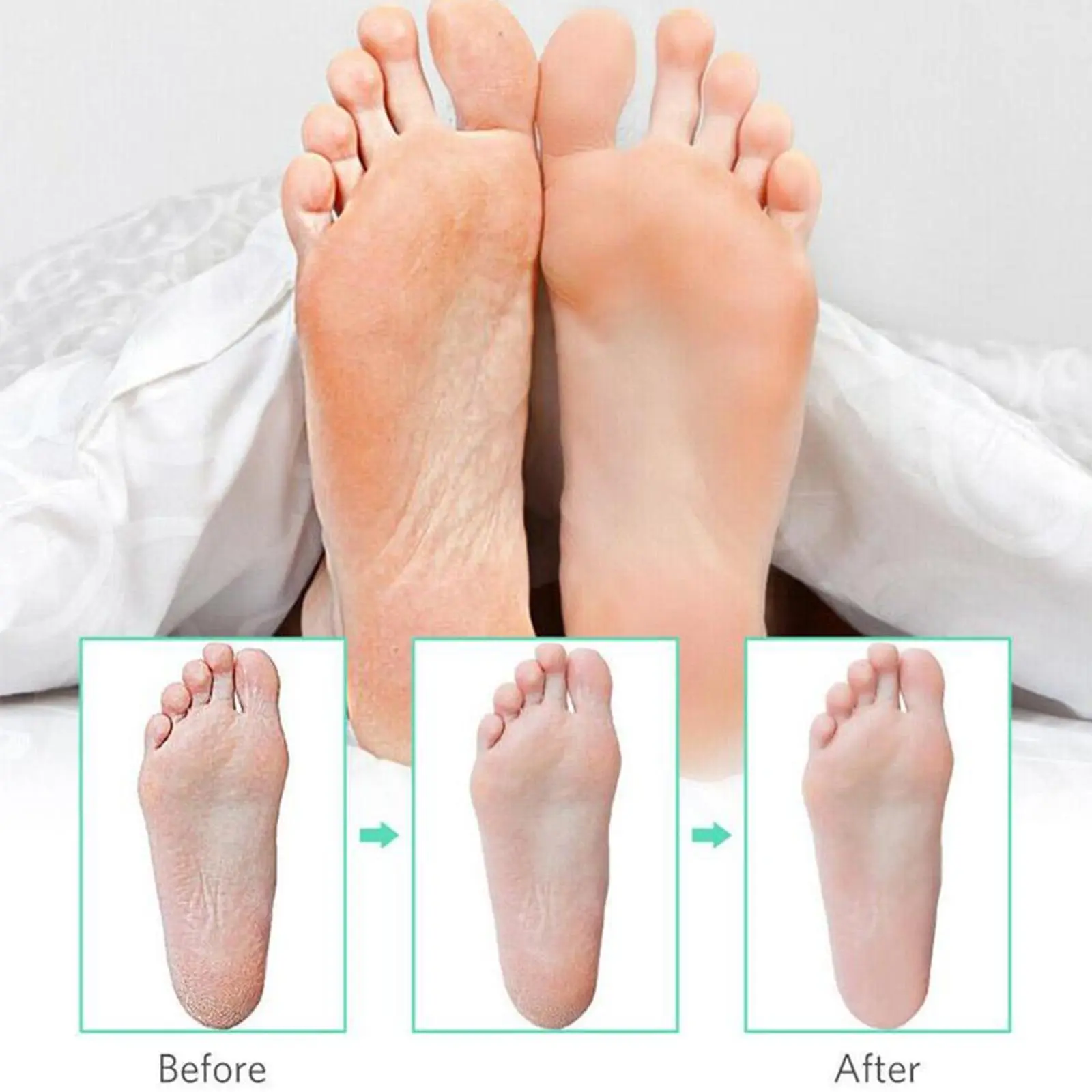 1/2 Boxes Callus Shaver Replacement Blades Corn Plane Stainless Steel Blades for Removing Callus Foot Care Pedicure Tools (100x)