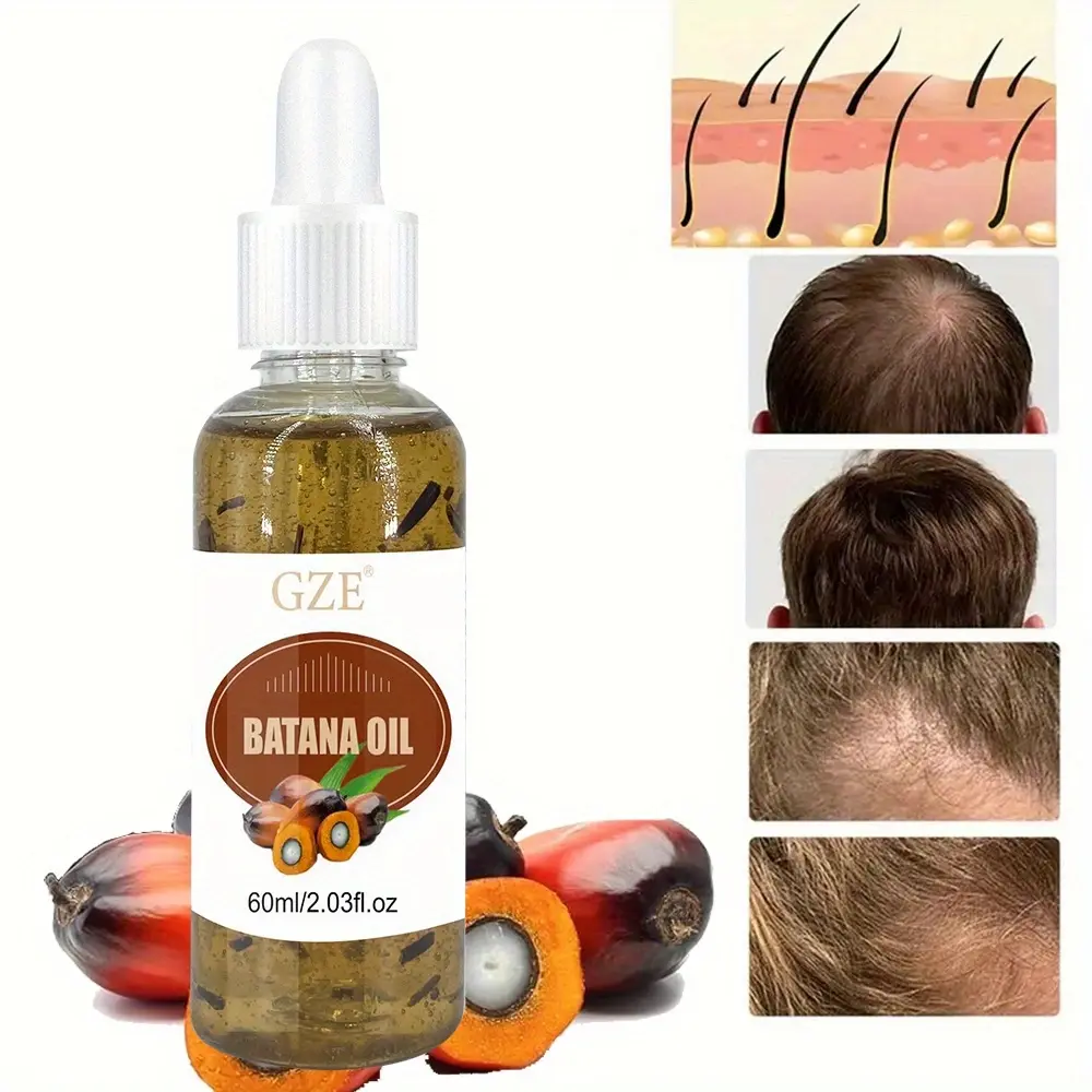 GZE Batana Oil Hair for Thicker, Fuller Hair - Unisex Adult Hair Care Strengthens Hair