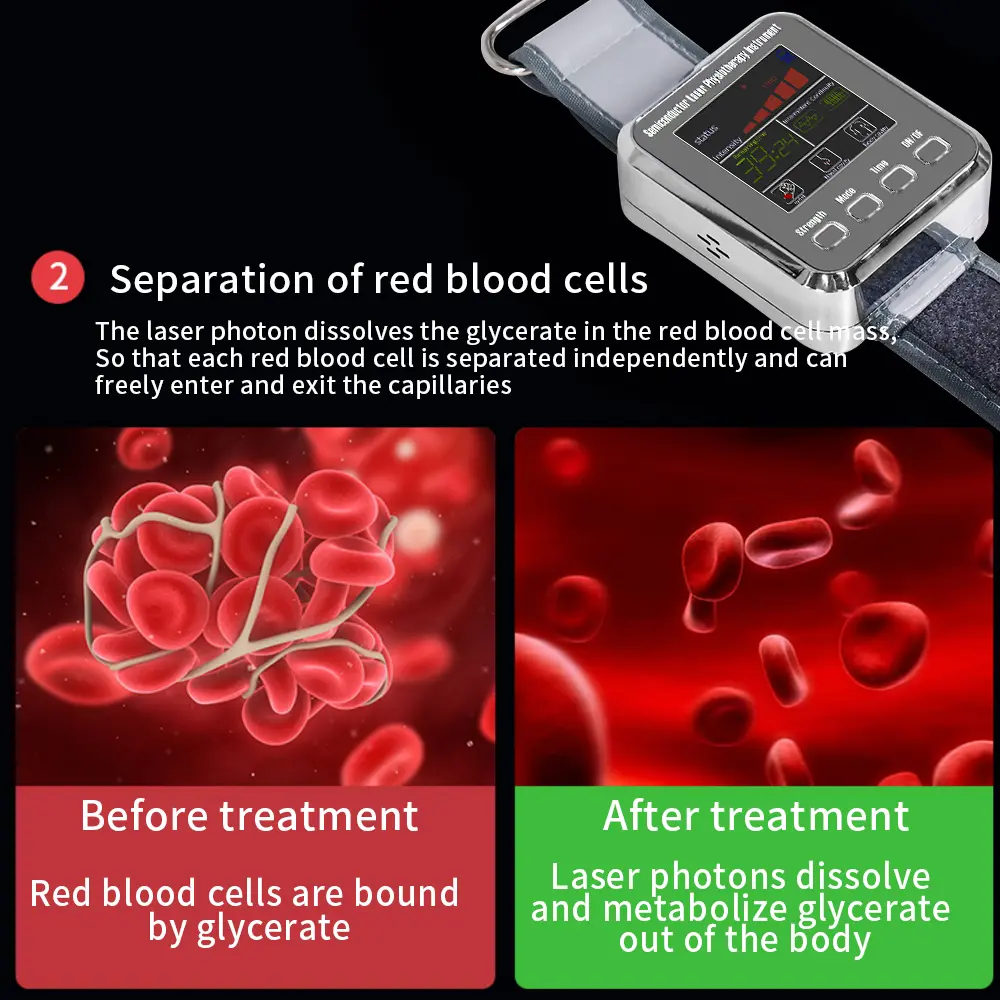 7 Holes Laser Watch Therapy 650nm Diabetic Watch Semiconductor Laser Treatment for High Blood Pressure Congested Nose Rhinitis