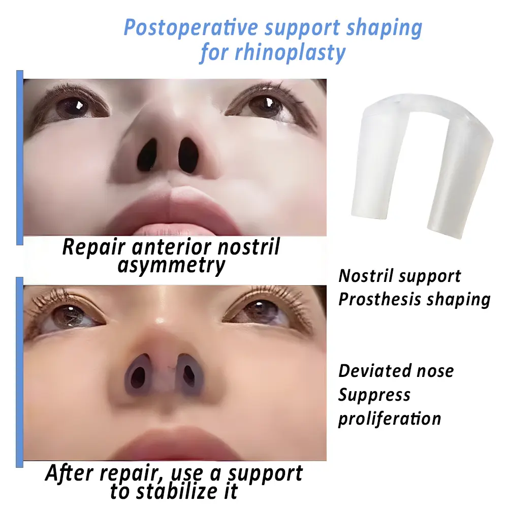 Postoperative Silica Gel Nose Clip Clear Silicone Shaping Nostril Support Shaping Rhinoplasty Painless Nose Lifting and Pulling