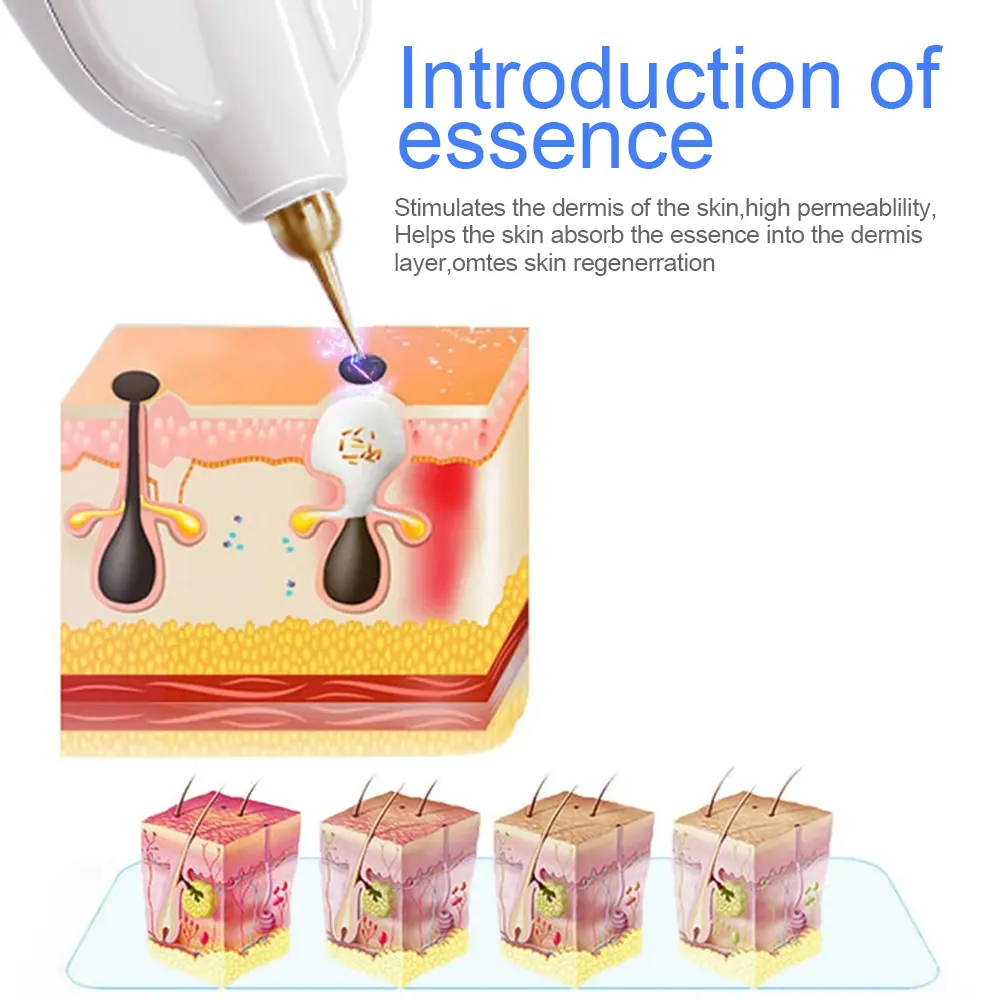 Plasma Pen Needles Replaceable Needles Accessories Fibroblasts Needles Wart Tag Tattoo Spot Mole Freckle Wrinkles Removal