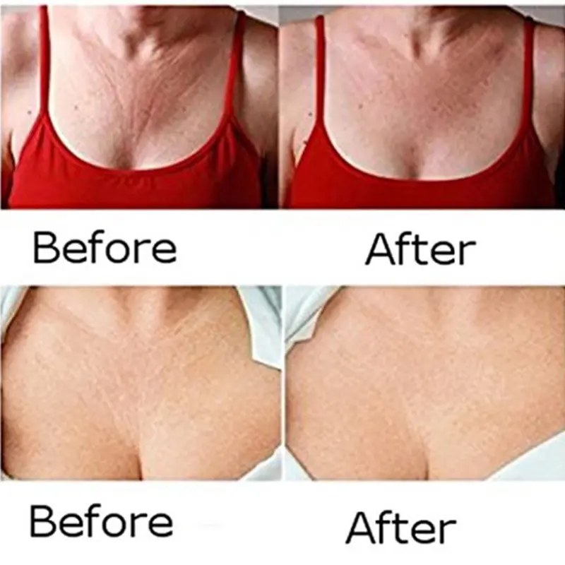 Reusable Silicone Anti-wrinkle Removal Sticker Skin Lifting Chest Patches Neck Line Remover Eye Patches Anti Aging Skin Pad